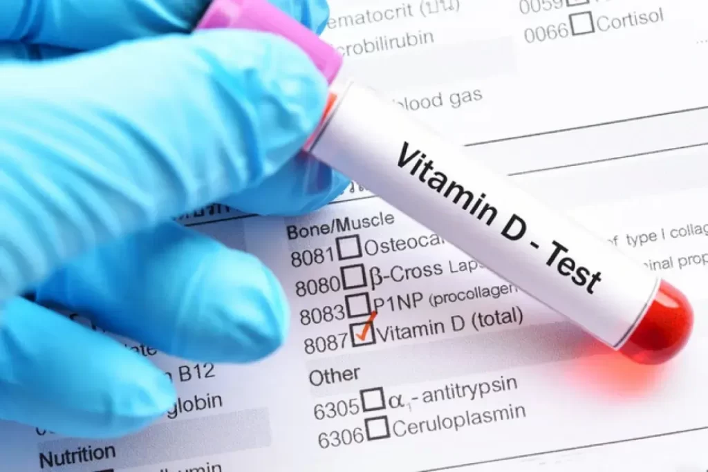 витамин д анализ