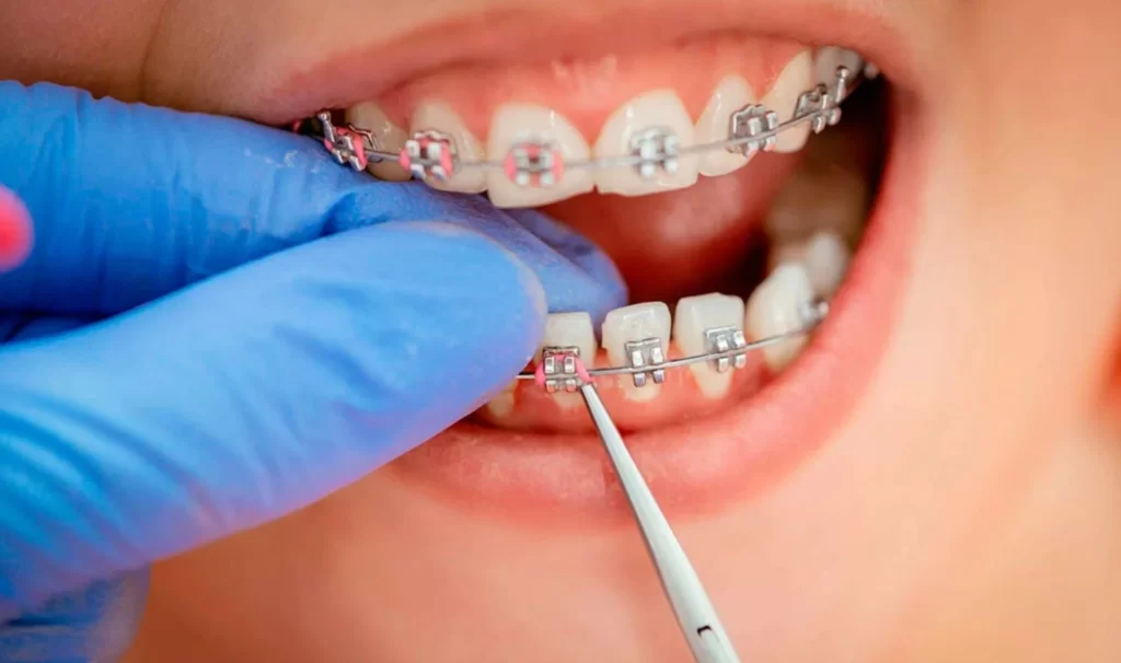 стоматологія осокорки