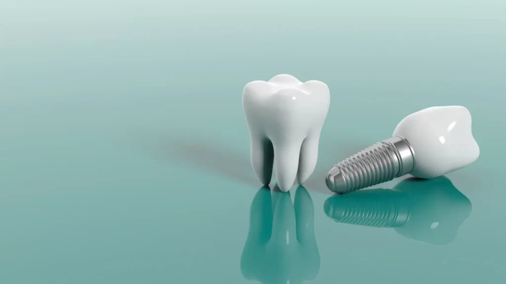 Ціна імплантації зуба