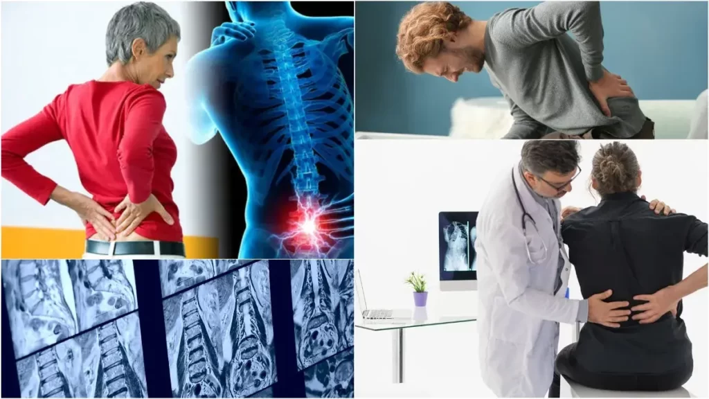 Біль у спині: симптоми, діагностика, лікування